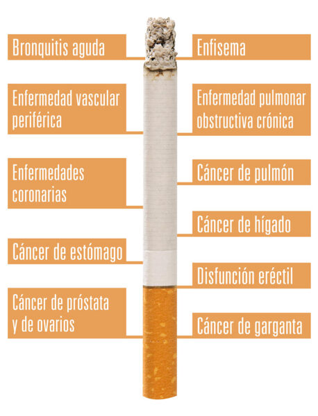 ACUPUNTURA /DEJAR DE FUMAR 